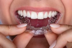 What Can I Eat and Drink with Invisalign?
