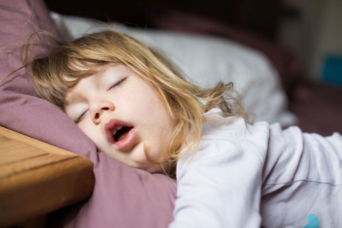 Sleep Apnea in Children